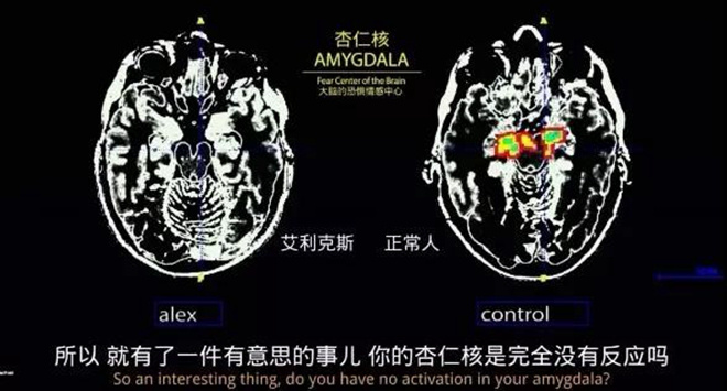 《徒手攀岩》这部奥斯卡最佳纪录片 拿命拍的！