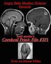 Cerebral Print: File #371