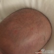 范瑋琪用母乳治愈愛子頭上痘痘 大呼“神奇”